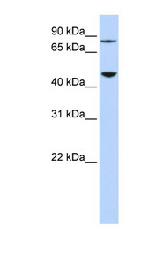 DPH2 Antibody - DPH2 antibody Western blot of 293T cell lysate. This image was taken for the unconjugated form of this product. Other forms have not been tested.