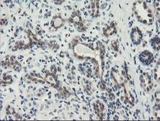 DPH2 Antibody - IHC of paraffin-embedded Human breast tissue using anti-DPH2 mouse monoclonal antibody. (Heat-induced epitope retrieval by 10mM citric buffer, pH6.0, 100C for 10min).