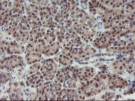 DPH2 Antibody - IHC of paraffin-embedded Human pancreas tissue using anti-DPH2 mouse monoclonal antibody. (Heat-induced epitope retrieval by 10mM citric buffer, pH6.0, 100C for 10min).