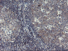 DPH2 Antibody - IHC of paraffin-embedded Human tonsil using anti-DPH2 mouse monoclonal antibody. (Heat-induced epitope retrieval by 10mM citric buffer, pH6.0, 100C for 10min).