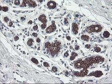 DPH2 Antibody - IHC of paraffin-embedded Human breast tissue using anti-DPH2 mouse monoclonal antibody.