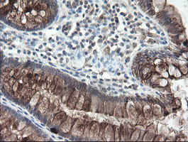 DPH2 Antibody - IHC of paraffin-embedded Human colon tissue using anti-DPH2 mouse monoclonal antibody.