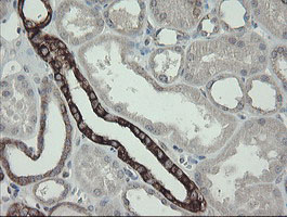 DPH2 Antibody - IHC of paraffin-embedded Human Kidney tissue using anti-DPH2 mouse monoclonal antibody.