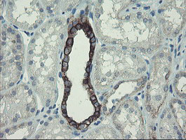 DPH2 Antibody - IHC of paraffin-embedded Human Kidney tissue using anti-DPH2 mouse monoclonal antibody.