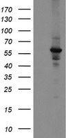DPH2 Antibody - HEK293T cells were transfected with the pCMV6-ENTRY control (Left lane) or pCMV6-ENTRY DPH2 (Right lane) cDNA for 48 hrs and lysed. Equivalent amounts of cell lysates (5 ug per lane) were separated by SDS-PAGE and immunoblotted with anti-DPH2.