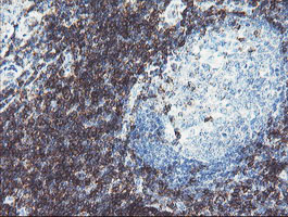 DPH2 Antibody - IHC of paraffin-embedded Human tonsil using anti-DPH2 mouse monoclonal antibody.