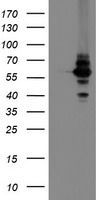 DPH2 Antibody - HEK293T cells were transfected with the pCMV6-ENTRY control (Left lane) or pCMV6-ENTRY DPH2 (Right lane) cDNA for 48 hrs and lysed. Equivalent amounts of cell lysates (5 ug per lane) were separated by SDS-PAGE and immunoblotted with anti-DPH2.