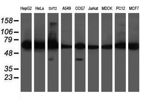 DPH2 Antibody - Western blot of extracts (35 ug) from 9 different cell lines by using anti-DPH2 monoclonal antibody (HepG2: human; HeLa: human; SVT2: mouse; A549: human; COS7: monkey; Jurkat: human; MDCK: canine; PC12: rat; MCF7: human).