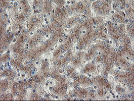 DPH2 Antibody - IHC of paraffin-embedded Human liver tissue using anti-DPH2 mouse monoclonal antibody.