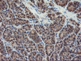 DPH2 Antibody - IHC of paraffin-embedded Human pancreas tissue using anti-DPH2 mouse monoclonal antibody.