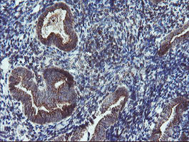 DPH2 Antibody - IHC of paraffin-embedded Human endometrium tissue using anti-DPH2 mouse monoclonal antibody.