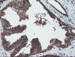 DPH2 Antibody - IHC of paraffin-embedded Human prostate tissue using anti-DPH2 mouse monoclonal antibody.