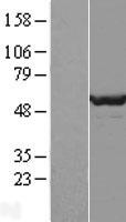 DPH2 Protein - Western validation with an anti-DDK antibody * L: Control HEK293 lysate R: Over-expression lysate