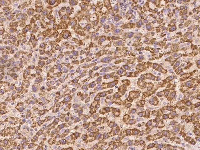 DPH5 Antibody - Immunochemical staining of human DPH5 in human liver with rabbit polyclonal antibody at 1:500 dilution, formalin-fixed paraffin embedded sections.