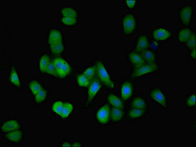 DPH6 / ATPBD4 Antibody - Immunofluorescent analysis of HepG2 cells using DPH6 Antibody at dilution of 1:100 and Alexa Fluor 488-congugated AffiniPure Goat Anti-Rabbit IgG(H+L)