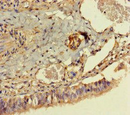 DPH7 / WDR85 Antibody - Immunohistochemistry of paraffin-embedded human lung tissue at dilution of 1:100