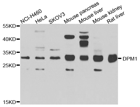 DPM1 Antibody - Western blot analysis of extracts of various cells.