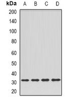 DPM1 Antibody - Western blot analysis of DPM1 expression in HeLa (A); SKOV3 (B); mouse kidney (C); rat liver (D) whole cell lysates.