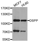 DPP / DSPP Antibody - Western blot analysis of extracts of various cells.
