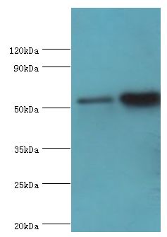 DPP2 / DPP7 Antibody - Western blot. All lanes: Dipeptidyl peptidase 2 antibody at 6 ug/ml. Lane 1: K562 whole cell lysate. Lane 2: rat brain tissue. Secondary antibody: Goat polyclonal to rabbit at 1:10000 dilution. Predicted band size: 54 kDa. Observed band size: 54 kDa Immunohistochemistry.