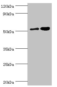 DPP2 / DPP7 Antibody - Western blot All lanes: Dipeptidyl peptidase 2 antibody at 6µg/ml Lane 1: K562 whole cell lysate Lane 2: Rat brain tissue Secondary Goat polyclonal to rabbit IgG at 1/10000 dilution Predicted band size: 54 kDa Observed band size: 54 kDa