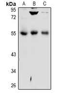 DPP2 / DPP7 Antibody - Western blot analysis of DPP7 expression in MCF7 (A), A549 (B), U87MG (C) whole cell lysates.