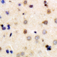 DPP2 / DPP7 Antibody - Immunohistochemical analysis of DPP7 staining in human brain formalin fixed paraffin embedded tissue section. The section was pre-treated using heat mediated antigen retrieval with sodium citrate buffer (pH 6.0). The section was then incubated with the antibody at room temperature and detected using an HRP conjugated compact polymer system. DAB was used as the chromogen. The section was then counterstained with haematoxylin and mounted with DPX.