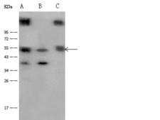 DPP2 / DPP7 Antibody - Anti-DPP7 rabbit polyclonal antibody at 1:500 dilution. Lane A: Mouse Kidney tissue lysate. Lane B: Mouse heart tissue lysate. Lane C: Mouse Spleen tissue lysate. Lysates/proteins at 30 ug per lane. Secondary: Goat Anti-Rabbit IgG (H+L)/HRP at 1/10000 dilution. Developed using the ECL technique. Performed under reducing conditions. Predicted band size: 54 kDa. Observed band size: 54 kDa.