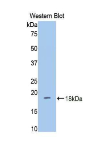 DPP4 / CD26 Antibody - Western blot of recombinant DPP4 / CD26.  This image was taken for the unconjugated form of this product. Other forms have not been tested.