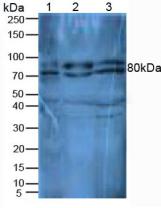 DPP4 / CD26 Antibody - Western Blot; Sample: Lane1: Mouse Thymus Tissue; Lane2: Mouse Liver Tissue; Lane3: Mouse Kidney Tissue.