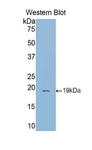 DPP4 / CD26 Antibody - Western blot of recombinant DPP4 / CD26.  This image was taken for the unconjugated form of this product. Other forms have not been tested.