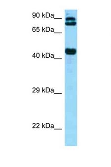 DPP4 / CD26 Antibody - DPP4 / CD26 antibody Western blot of 721_B Cell lysate. Antibody concentration 1 ug/ml.  This image was taken for the unconjugated form of this product. Other forms have not been tested.