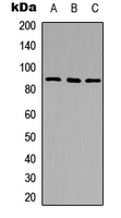 DPP4 / CD26 Antibody - Western blot analysis of CD26 expression in HEK293T (A); NS-1 (B); PC12 (C) whole cell lysates.