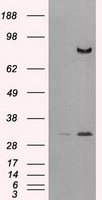 DPP4 / CD26 Antibody - HEK293T cells were transfected with the pCMV6-ENTRY control (Left lane) or pCMV6-ENTRY DPP4 (Right lane) cDNA for 48 hrs and lysed. Equivalent amounts of cell lysates (5 ug per lane) were separated by SDS-PAGE and immunoblotted with anti-DPP4.