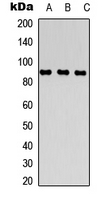 DPP4 / CD26 Antibody - Western blot analysis of CD26 expression in Ramos (A); HUVEC (B); NIH3T3 (C) whole cell lysates.