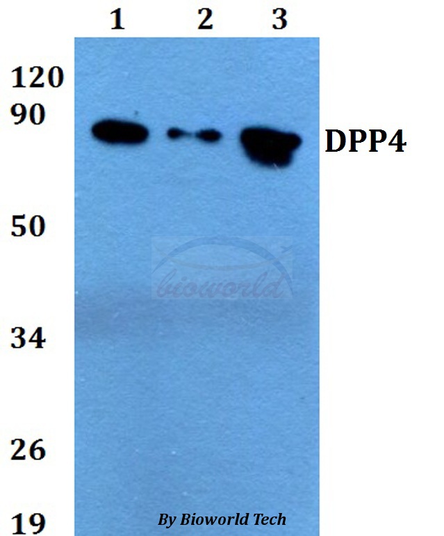 DPP4 / CD26 Antibody - Western blot of DPP4 antibody at 1:500 dilution. Lane 1: HEK293T whole cell lysate. Lane 2: sp2/0 whole cell lysate. Lane 3: PC12 whole cell lysate.