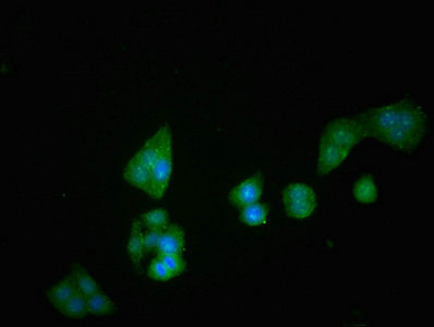 DPP4 / CD26 Antibody - Immunofluorescent analysis of PC3 cells at a dilution of 1:100 and Alexa Fluor 488-congugated AffiniPure Goat Anti-Rabbit IgG(H+L)