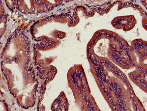 DPP4 / CD26 Antibody - Immunohistochemistry image of paraffin-embedded human prostate tissue at a dilution of 1:100