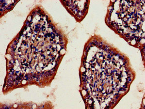 DPP4 / CD26 Antibody - Immunohistochemistry image of paraffin-embedded human small intestine tissue at a dilution of 1:100