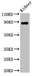 DPP4 / CD26 Antibody - Positive Western Blot detected in Rat kidney tissue. All lanes: DPP4 antibody at 2.8 µg/ml Secondary Goat polyclonal to rabbit IgG at 1/50000 dilution. Predicted band size: 89 KDa. Observed band size: 89 KDa