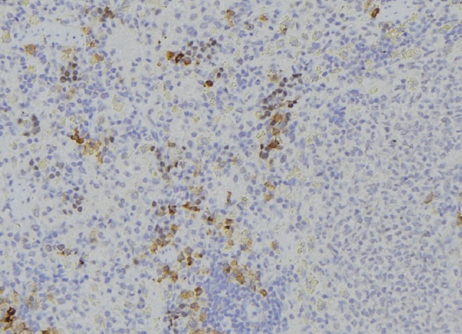 DPP4 / CD26 Antibody - 1:100 staining human lymph node tissue by IHC-P. The sample was formaldehyde fixed and a heat mediated antigen retrieval step in citrate buffer was performed. The sample was then blocked and incubated with the antibody for 1.5 hours at 22°C. An HRP conjugated goat anti-rabbit antibody was used as the secondary.