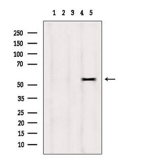 DPP4 / CD26 Antibody - Western blot analysis of extracts of HepG2 cells using DPP4 antibody. Lane 1 was treated with the blocking peptide.