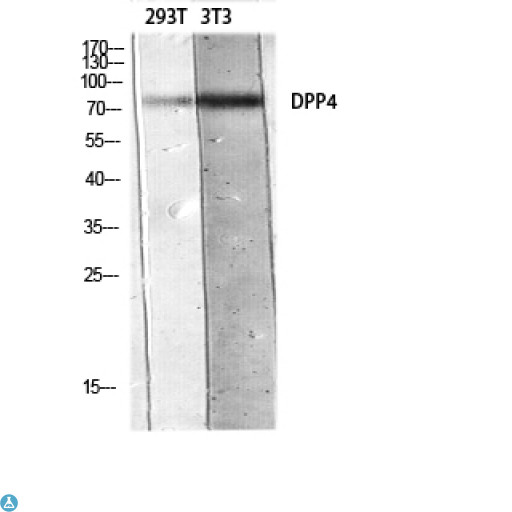 DPP4 / CD26 Antibody - Immunohistochemistry (IHC) analysis of paraffin-embedded Human Kidney, antibody was diluted at 1:200.