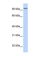 DPP6 / Dipeptidylpeptidase 6 Antibody - DPP6 antibody Western blot of Fetal Brain lysate. This image was taken for the unconjugated form of this product. Other forms have not been tested.
