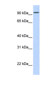 DPP6 / Dipeptidylpeptidase 6 Antibody - DPP6 antibody Western blot of Fetal Muscle lysate. This image was taken for the unconjugated form of this product. Other forms have not been tested.