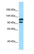 DPP9 Antibody - DPP9 antibody Western Blot of MCF7.  This image was taken for the unconjugated form of this product. Other forms have not been tested.