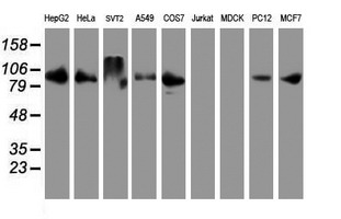 DPP9 Antibody - Western blot of extracts (35 ug) from 9 different cell lines by using anti-DPP9 monoclonal antibody.