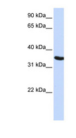 DPPA2 Antibody - DPPA2 antibody Western blot of HepG2 cell lysate. This image was taken for the unconjugated form of this product. Other forms have not been tested.