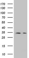 DPPA2 Antibody - HEK293T cells were transfected with the pCMV6-ENTRY control (Left lane) or pCMV6-ENTRY DPPA2 (Right lane) cDNA for 48 hrs and lysed. Equivalent amounts of cell lysates (5 ug per lane) were separated by SDS-PAGE and immunoblotted with anti-DPPA2.