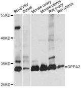 DPPA2 Antibody - Western blot analysis of extracts of various cell lines, using DPPA2 antibody at 1:1000 dilution. The secondary antibody used was an HRP Goat Anti-Rabbit IgG (H+L) at 1:10000 dilution. Lysates were loaded 25ug per lane and 3% nonfat dry milk in TBST was used for blocking. An ECL Kit was used for detection and the exposure time was 10s.